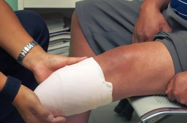 Riesgo de amputación